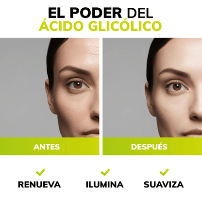 Acido Glicólico al 10% Piel rejuvenecida